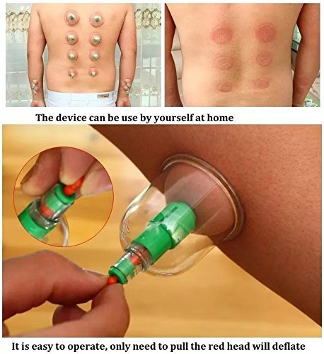 12 PIS SET VACUUM ACUPUNCTURE CUPPING 9