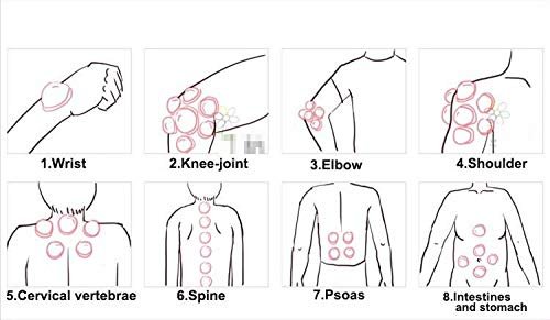 12 PIS SET VACUUM ACUPUNCTURE CUPPING 13