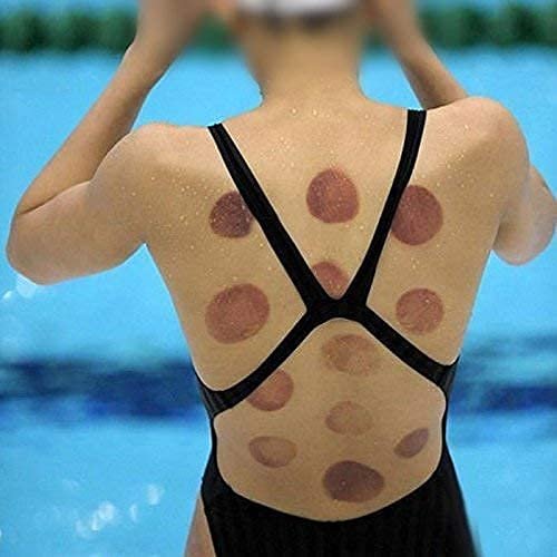12 PIS SET VACUUM ACUPUNCTURE CUPPING 15
