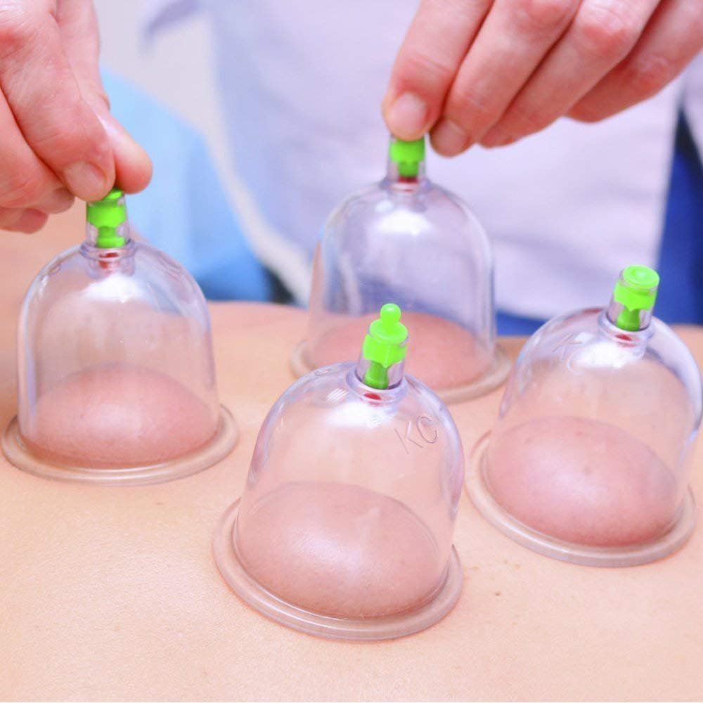 12 PIS SET VACUUM ACUPUNCTURE CUPPING 17